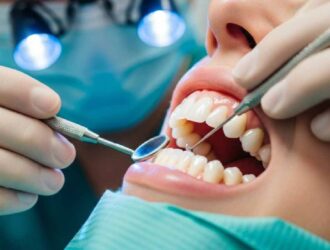 care for aligned teeth