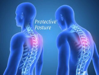 protective posture
