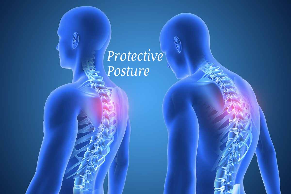 protective posture